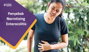 Read more about the article Penyebab Necrotizing Enterocolitis