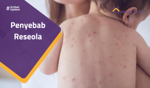 Read more about the article Penyebab Roseola