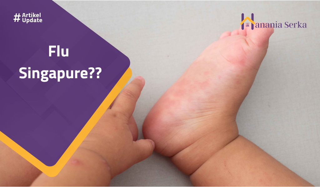 You are currently viewing Flu Singapure??