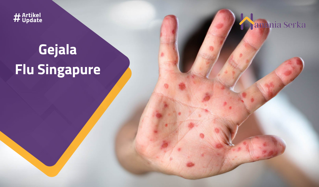 You are currently viewing Gejala Flu Singapure