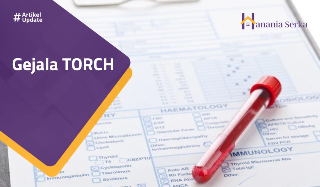 You are currently viewing Gejala TORCH