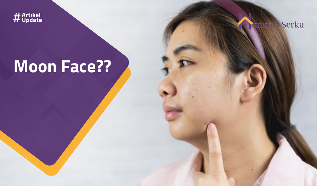 You are currently viewing Moon Face??