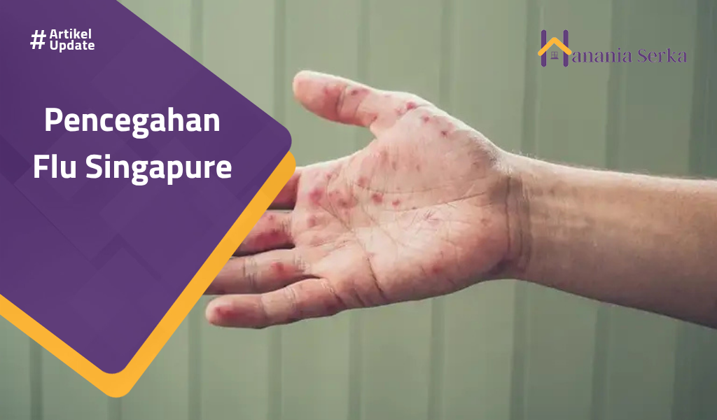 You are currently viewing Pencegahan Flu Singapure