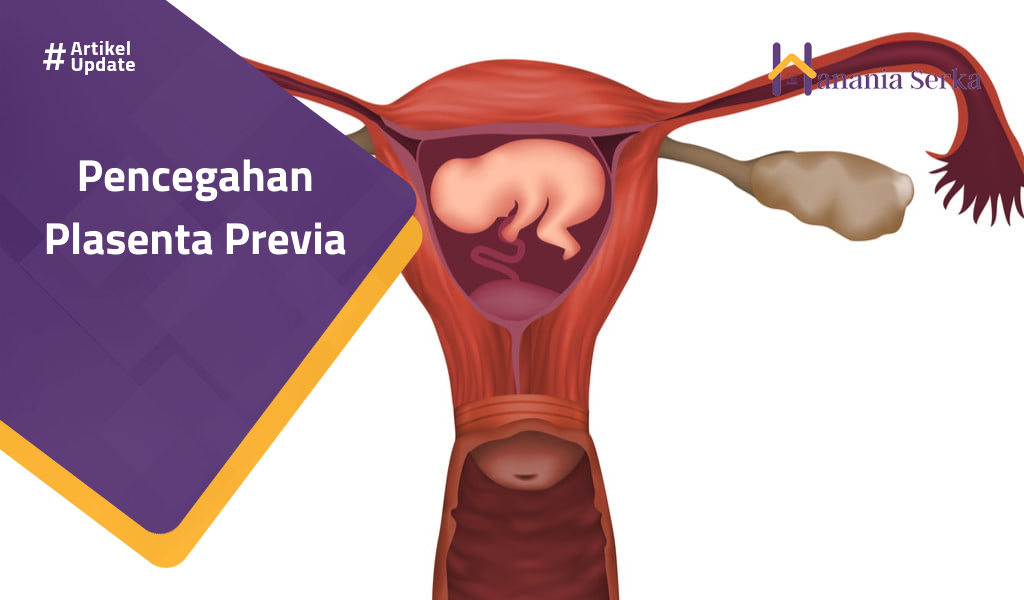 You are currently viewing Pencegahan Plasenta Previa
