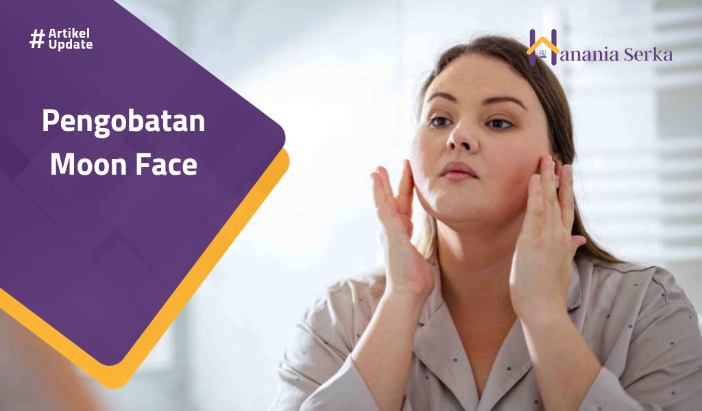 Read more about the article Pengobatan Moon Face