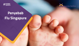 Read more about the article Penyebab Flu Singapure