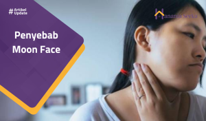 Read more about the article Penyebab Moon Face