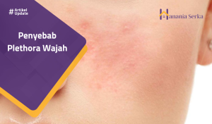 Read more about the article Penyebab Plethora Wajah