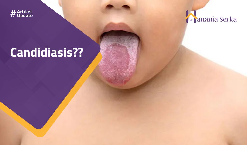 You are currently viewing Candidiasis??