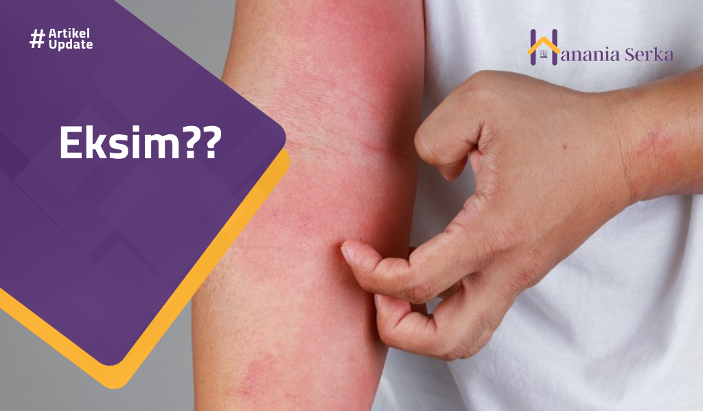 You are currently viewing Eksim??