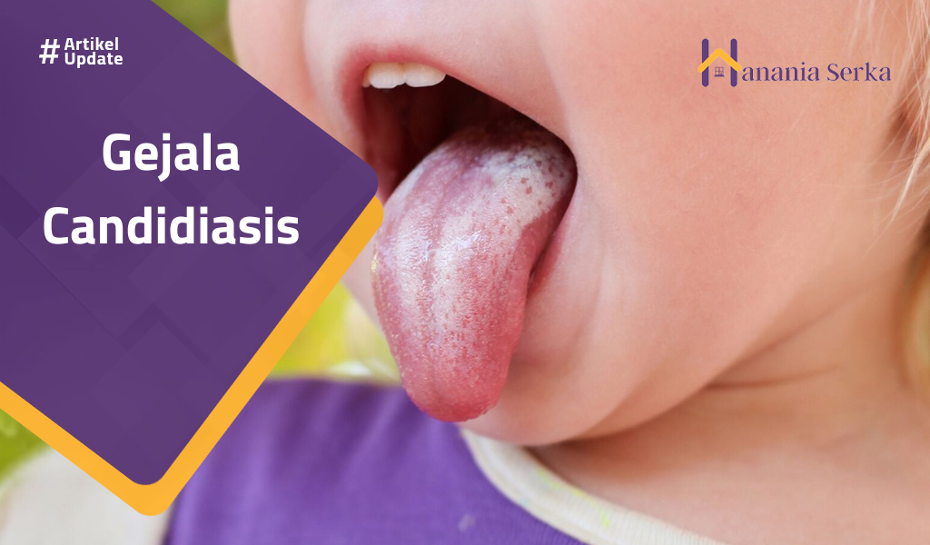 You are currently viewing Gejala Candidiasis