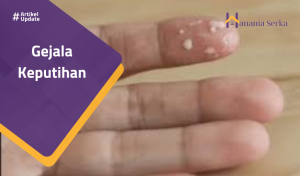 Read more about the article Gejala Keputihan