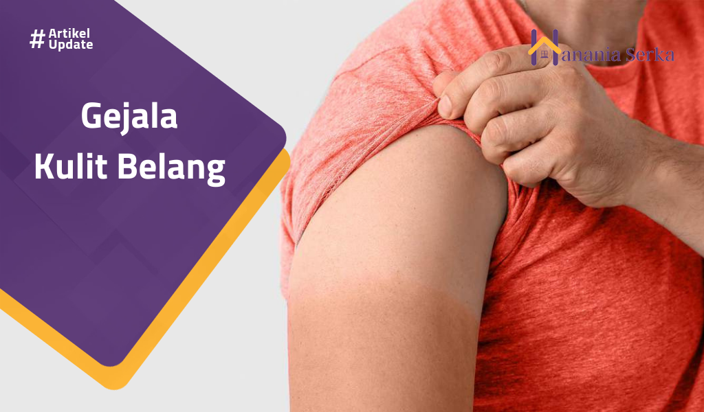 You are currently viewing Gejala Kulit Belang
