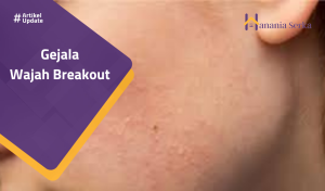 Read more about the article Gejala Wajah Breakout