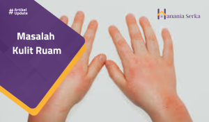 Read more about the article Masalah Kulit Ruam
