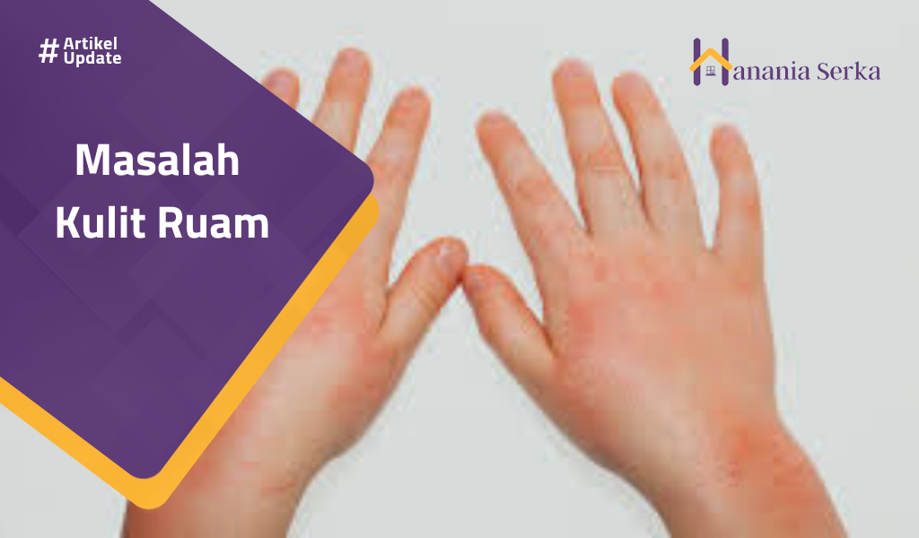 Read more about the article Masalah Kulit Ruam