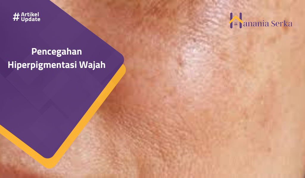 Read more about the article Pencegahan Hiperpigmentasi Wajah
