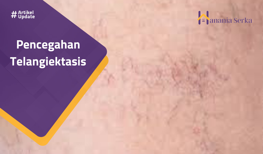 Read more about the article Pencegahan Telangiektasis