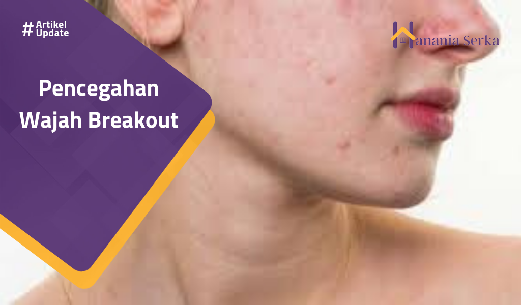 You are currently viewing Pencegahan Wajah Breakout