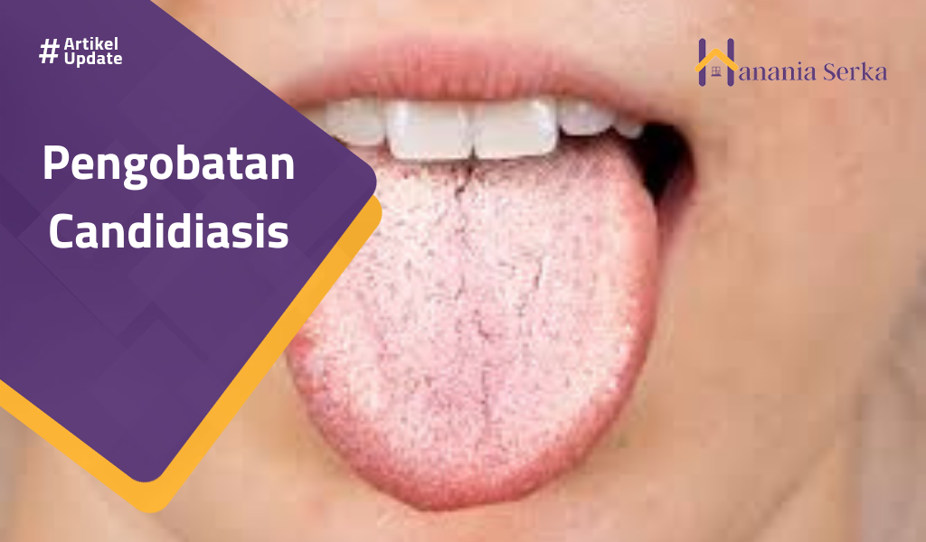 Read more about the article Pengobatan Candidiasis