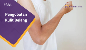 Read more about the article Pengobatan Kulit Belang
