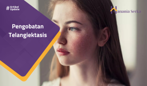 Read more about the article Pengobatan Telangiektasis