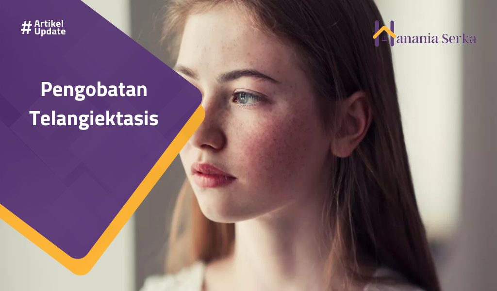 You are currently viewing Pengobatan Telangiektasis