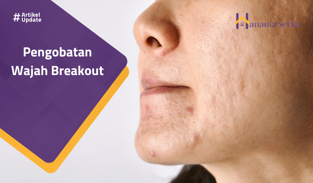 Read more about the article Pengobatan Wajah Breakout