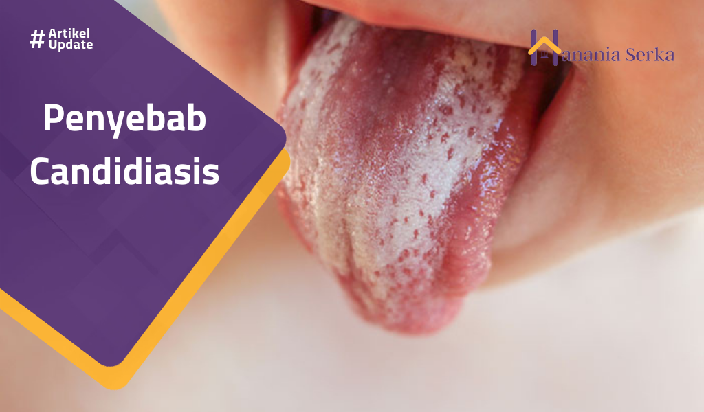 You are currently viewing Penyebab Candidiasis