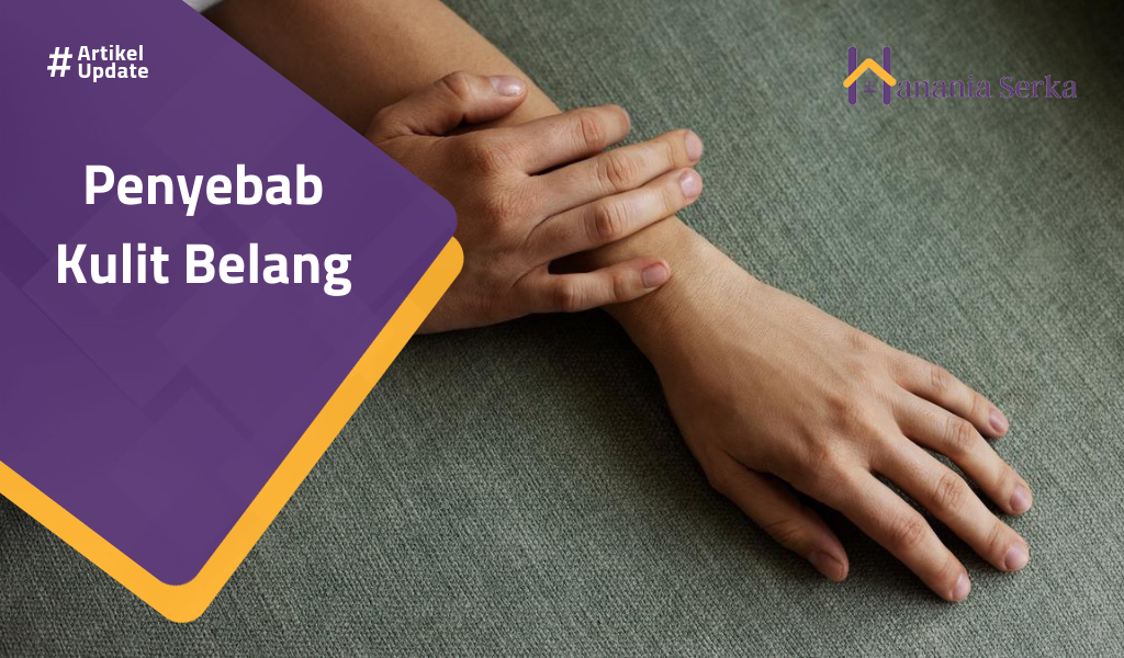 You are currently viewing Penyebab Kulit Belang