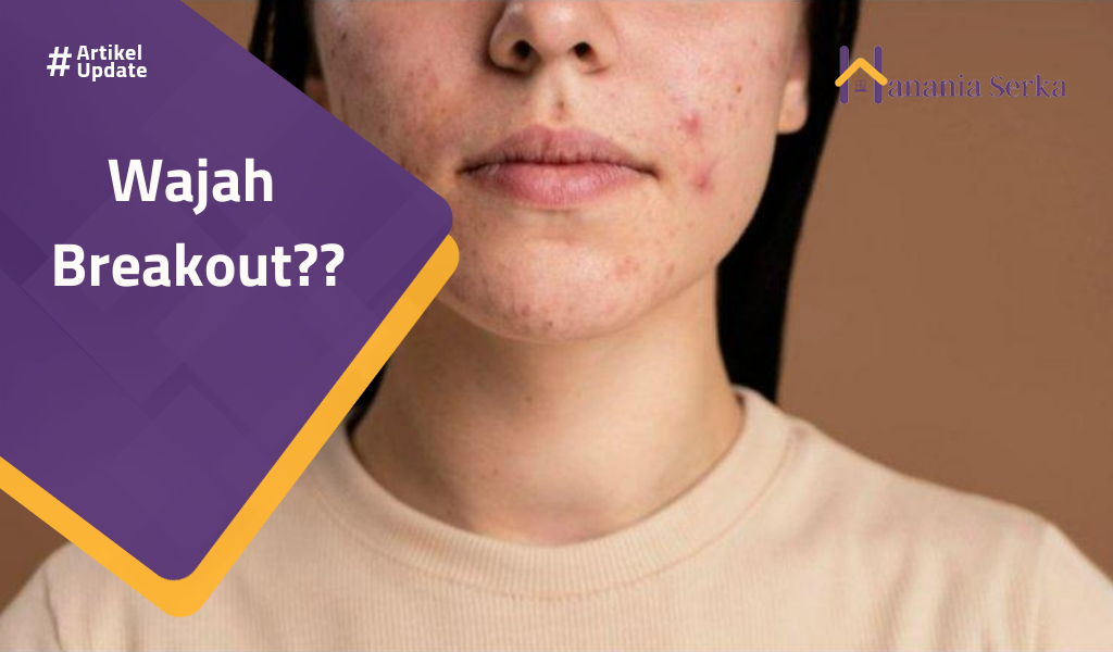 Read more about the article Wajah Breakout??