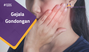 Read more about the article Gejala Gondongan