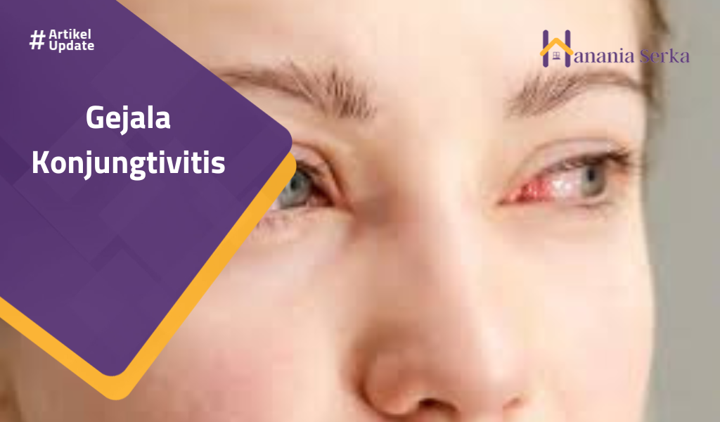 You are currently viewing Gejala Konjungtivitis