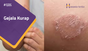 Read more about the article Gejala Kurap