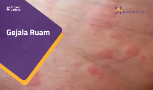 Read more about the article Gejala Ruam