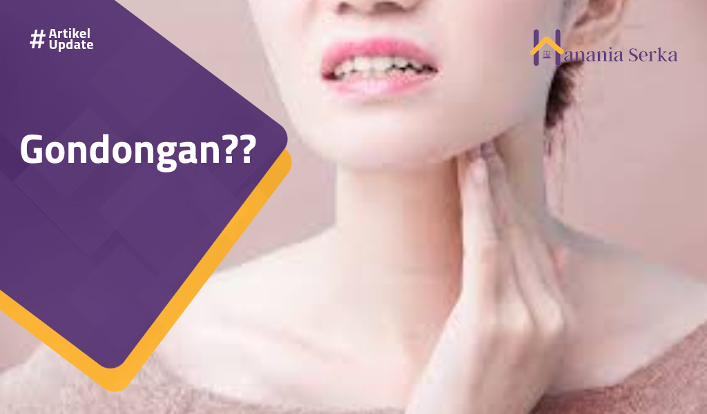 You are currently viewing Gondongan??