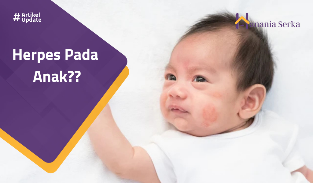 You are currently viewing Herpes Pada Anak??