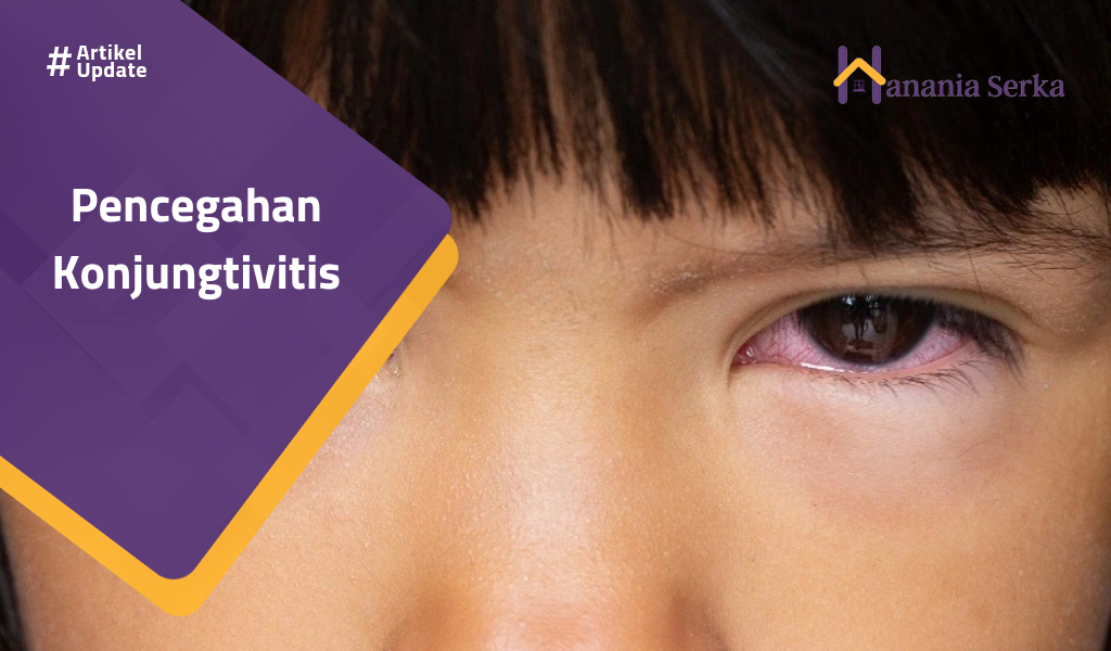 You are currently viewing Pencegahan Konjungtivitis