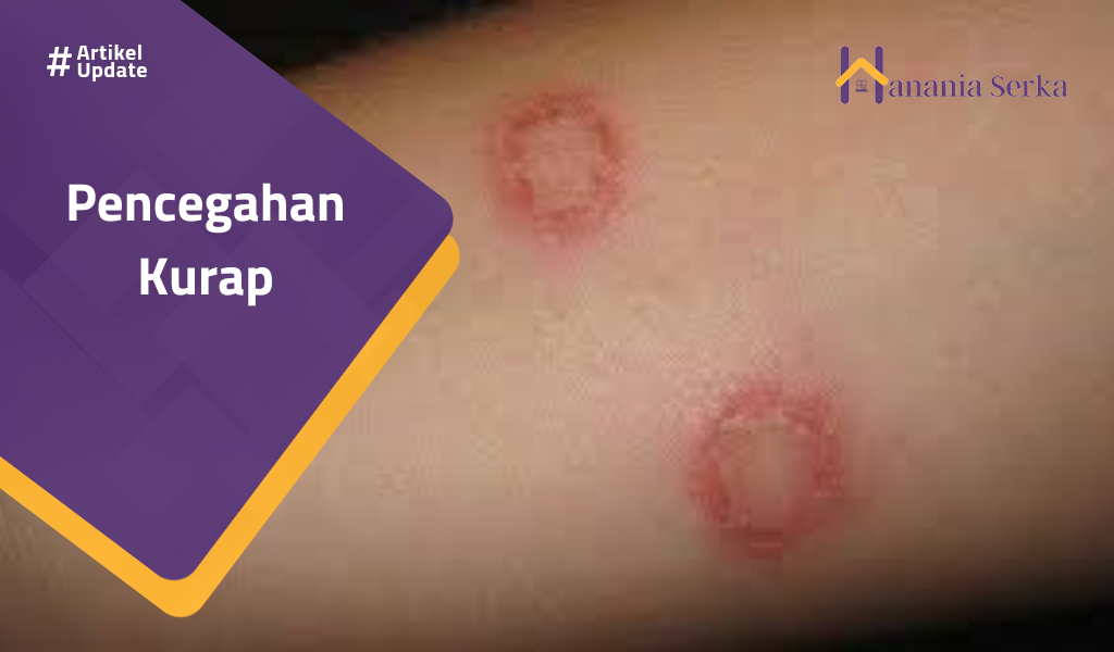 You are currently viewing Pencegahan Kurap