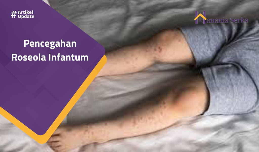 Read more about the article Pencegahan Roseola Infantum