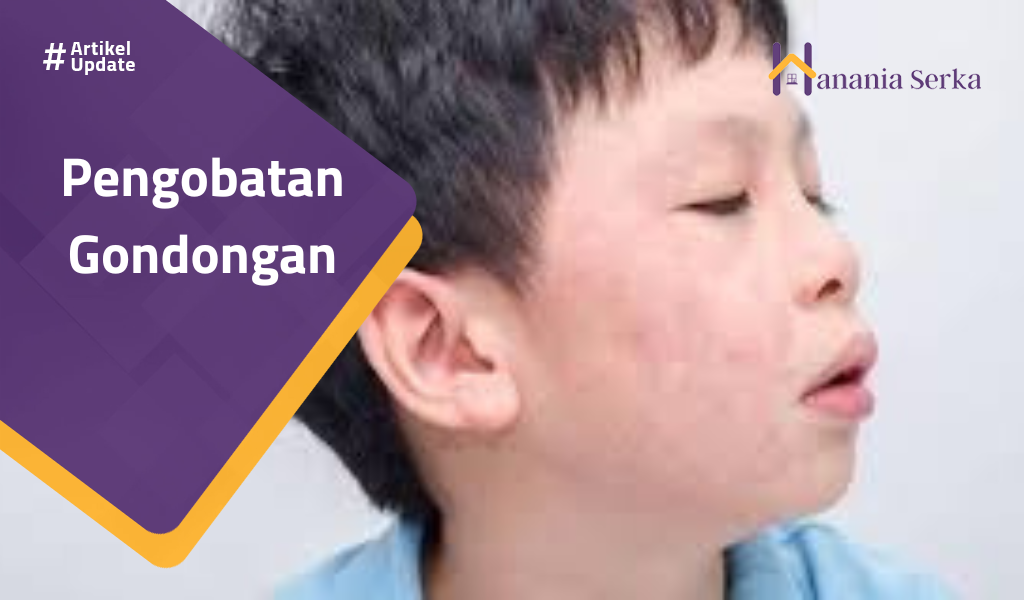 Read more about the article Pengobatan Gondongan