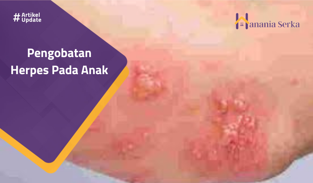 Read more about the article Pengobatan Herpes Pada Anak
