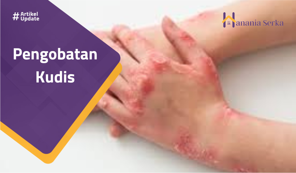 Read more about the article Pengobatan Kudis