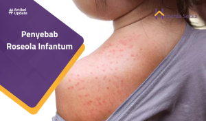 Read more about the article Penyebab Roseola Infantum