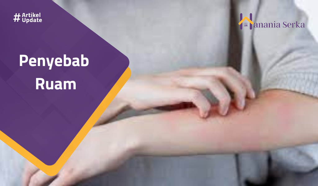 You are currently viewing Penyebab Ruam