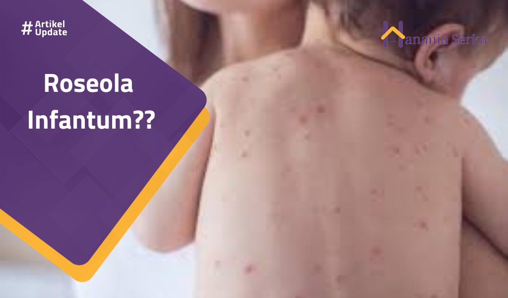 You are currently viewing Roseola Infantum??