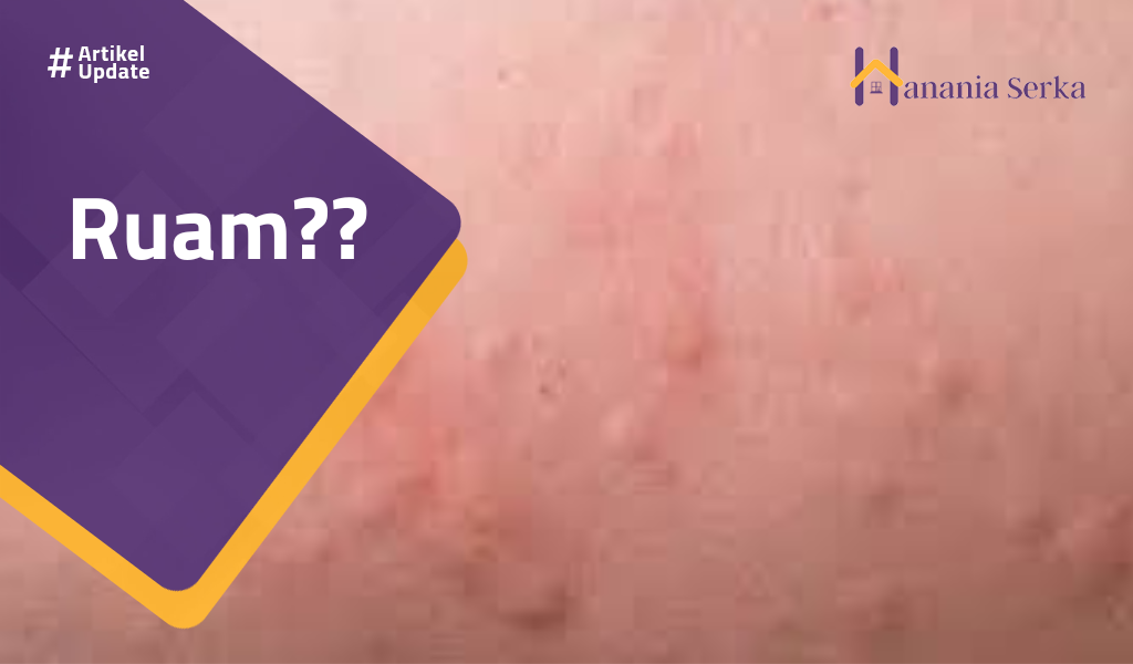 You are currently viewing Ruam??