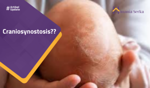 Read more about the article Craniosynostasis??