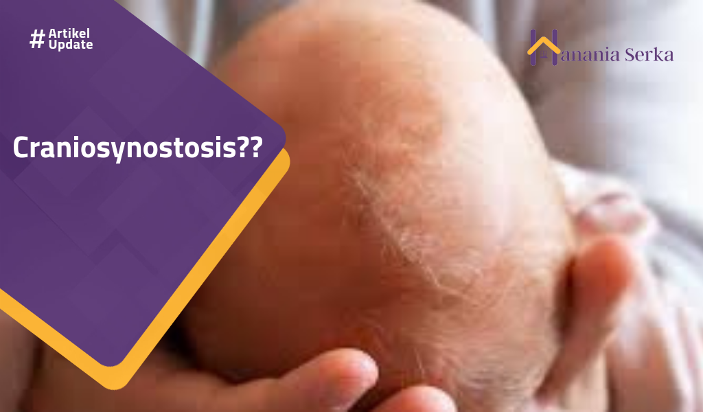 Read more about the article Craniosynostasis??