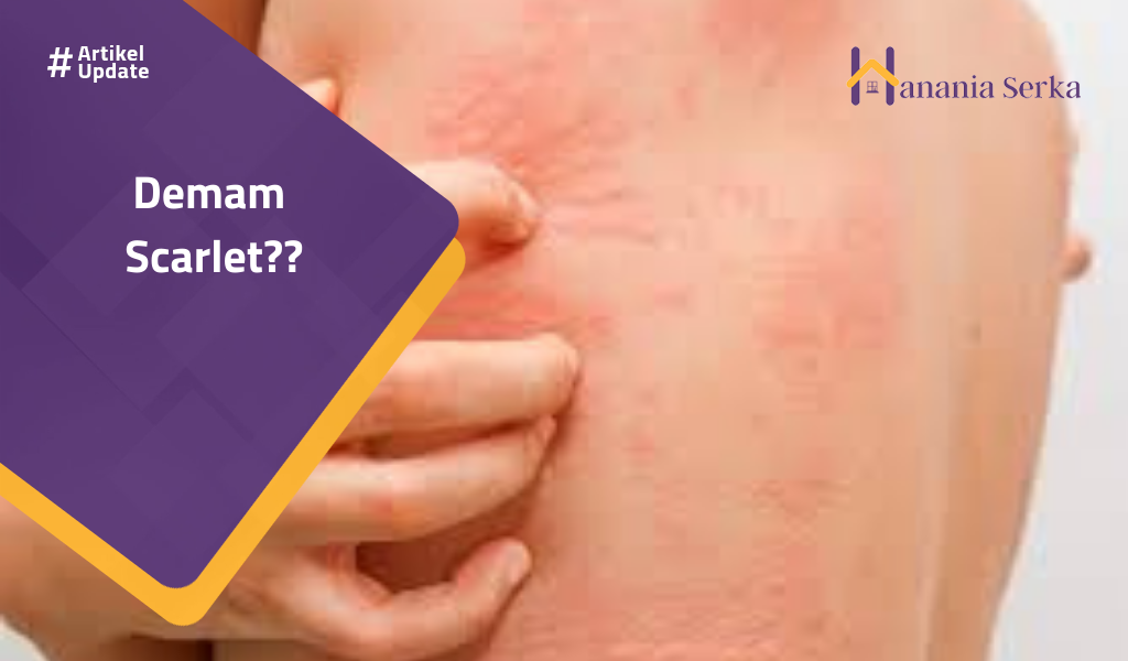 Read more about the article Demam Scarlet??